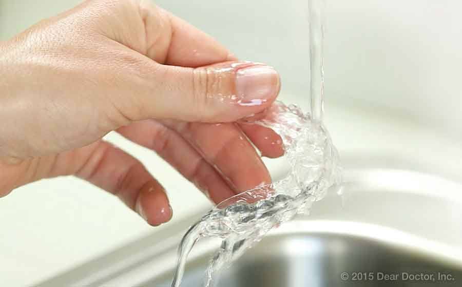 مراقبت و تمیز کردن نگهدارنده (ریتینر) ارتودنسی
