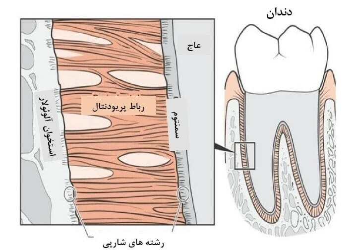 شکل- بافتهای رشته ای اطراف ریشه دندان رباط پریودنتال نام دارد (نواحی نارنجی رنگ در شکل بالا) که دندان را متصل به استخوان نگه میدارد.
