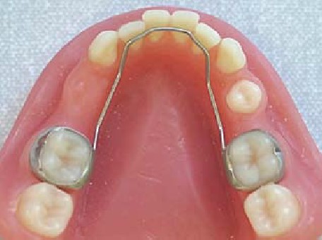 انواع ابزارهای ارتودنسی