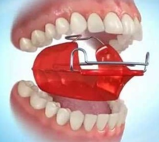 انواع ابزارهای ارتودنسی