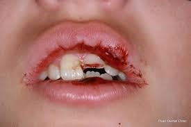 فوریت های دندانپزشکی