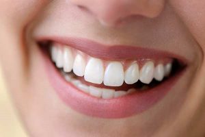  ایمپلنت دندانی یک روزه یا فوری