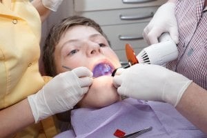 سیلانت برای محافظت از دندان