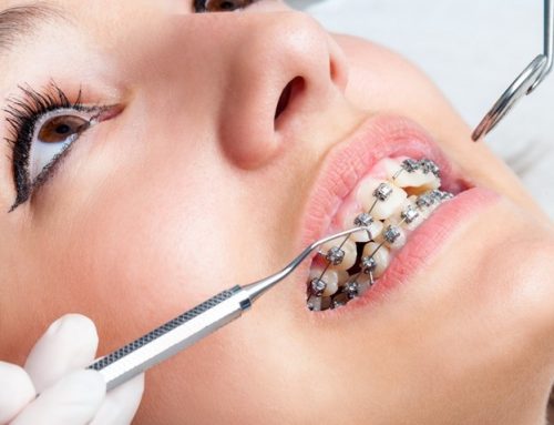 تأثیر داروها روی سرعت جابجایی دندان ها
