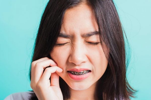 حساسیت دندان ها پس از ارتودنسی