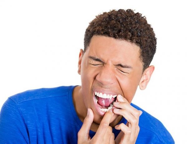 عادت های بد دندانی