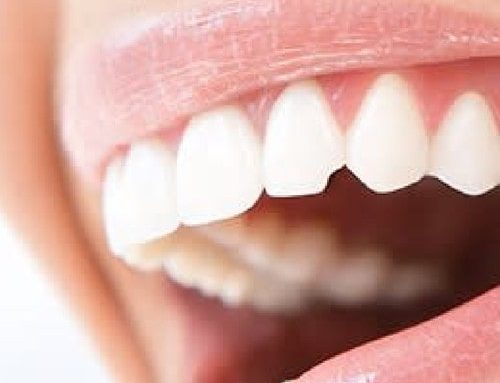 علت شکستن دندان ها چیست؟