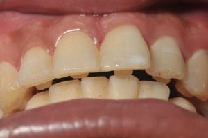 بایت رایزرها چگونه به نظر می رسند و چگونه می توانم آنها را جا بدهم؟