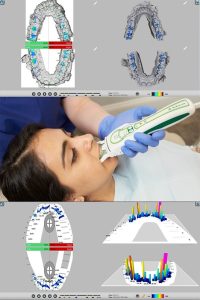 مزایای تشخیص مشکلات بایت با تی اسکن چیست؟