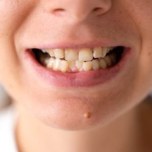 مشکلات مربوط به سلامت دندان کدامند؟