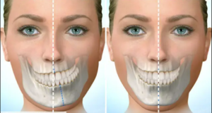 چه اختلالات ارتودنسی در صورت نامتقارن نقش دارند؟