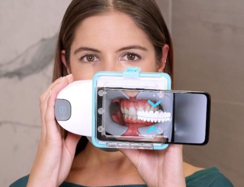 آیا واقعاً می توان با ارتودنسی از راه دور بریس ها را از راه دور کنترل کرد؟