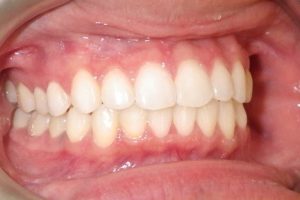 ویژگی های بایت ایده آل