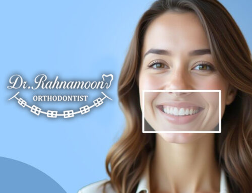 آیا براکت آمریکایی بهتر از براکت چینی است؟ حقیقتی که بسیاری از بیماران نمی‌دانند