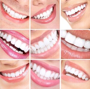 ارتباط بین زیبایی و سلامت ساختاری