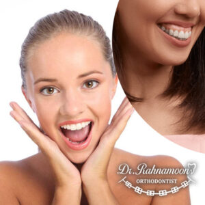 اصطلاح پزشکی برای لبخند لثه ای، نمایش بیش از حد لثه است.