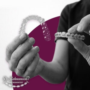 براکت ابزار است؛ متخصص، معمار لبخند شماست
