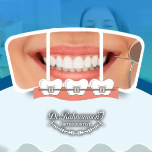 تکنولوژی؛ یکی از مهم‌ترین معیارهای انتخاب