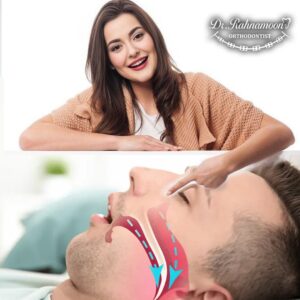 جراحی ارتوگناتیک برای آپنه خواب