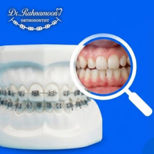 طراحی درمان اختصاصی یعنی