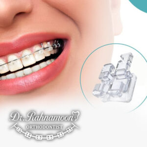چرا طراحی درمان اختصاصی، قلب ارتودنسی موفق است؟