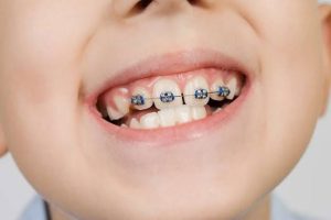 چرا حتی اگر به درمان نیاز نباشد، ارزیابی زود هنگام مفید است؟