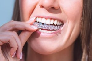 آیا ریتینرها می توانند تغییرات بایت را برطرف کنند؟